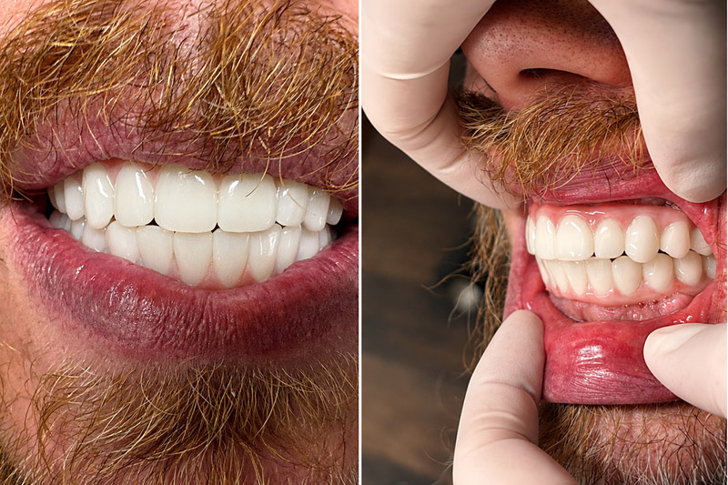 Cosmetic Dental Services in Albemarle